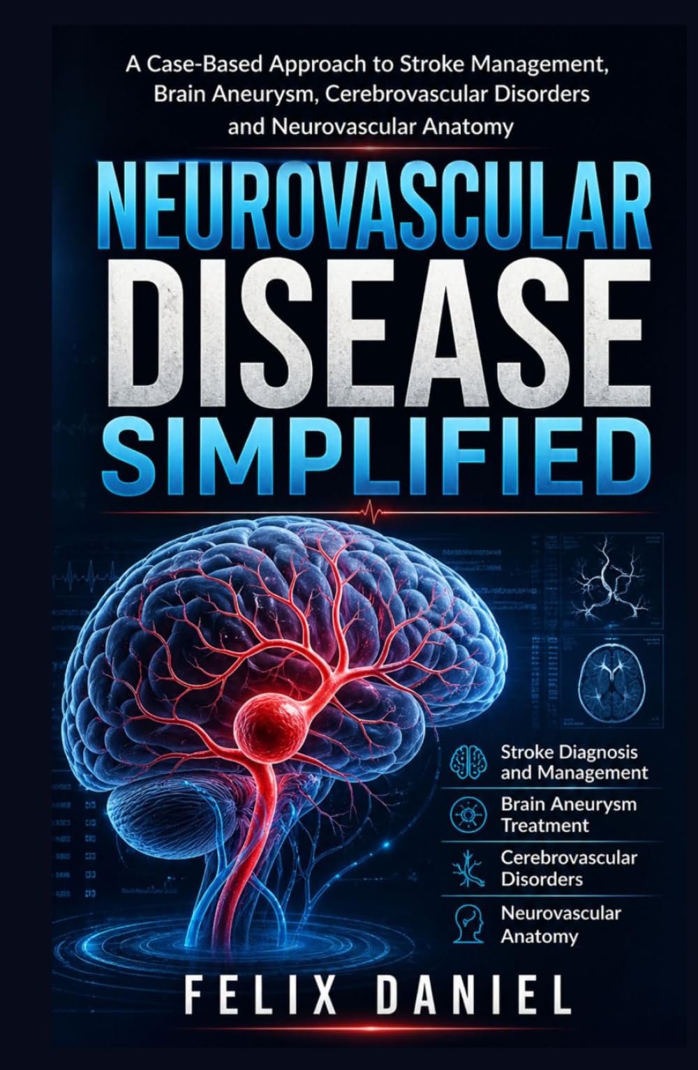 Neurovascular Disease Simplified: A Case-Based Approach to Stroke Management, Brain Aneurysm, Cerebrovascular Disorders and Neurovascular Anatomy for Medical Students and Residents