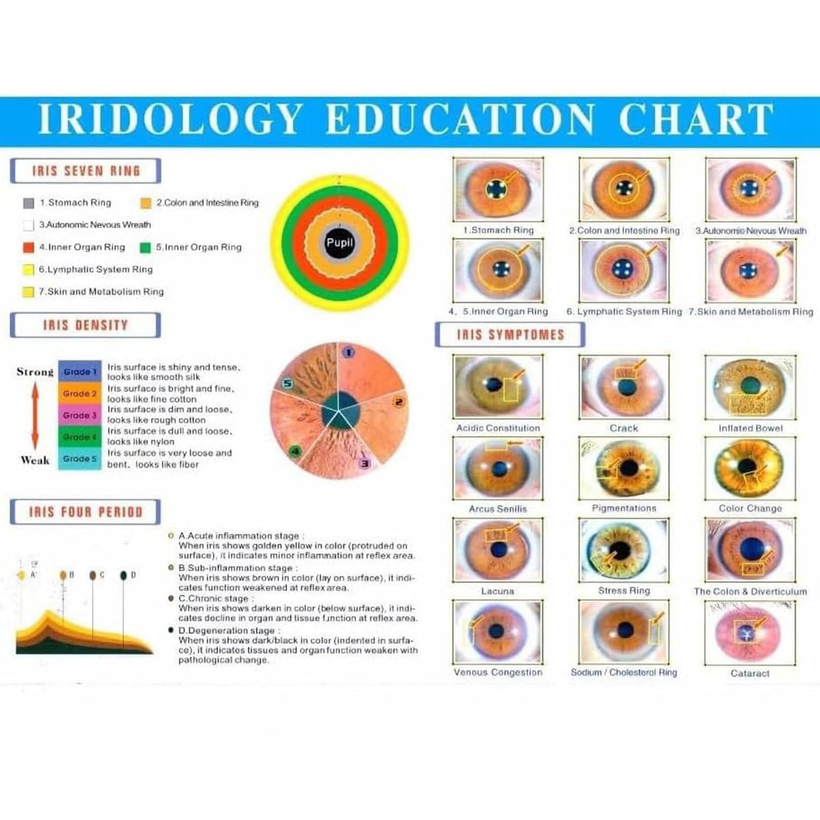 USB-Iris-Analysegerät Irisdiagnostik-Kamera mit HD-Auflösung (13 Millionen Pixel), Links-/Rechts-/USB-Lampenanalysegerät mit Iris-Software, 30-Fach Verstellbarer Fokus der Iris-Linse
