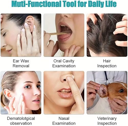 Miniatura 6 de Zone Flex - Eliminación de cera de oídos, cámara Fonenyca 2024 de 1080p, limpiador de cera de oídos Fonenyca, eliminación de cera de oído Loft Pro,