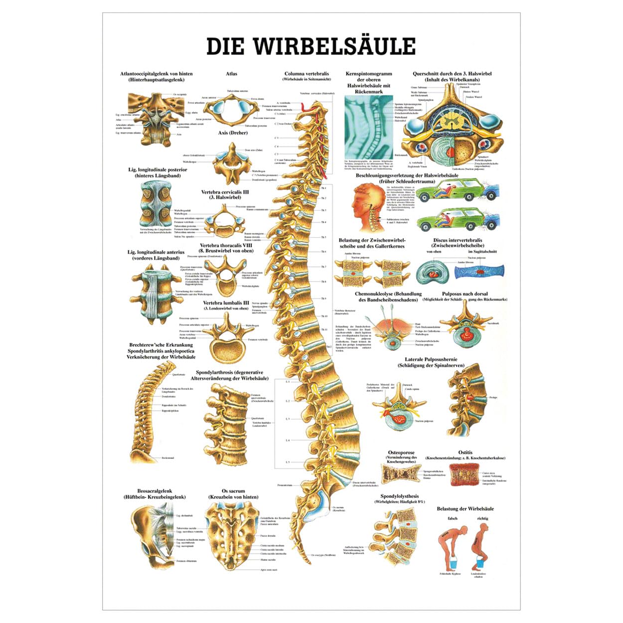 Sport-Tec Die Wirbelsäule Lehrtafel Anatomie 100x70 cm medizinische Lehrmittel