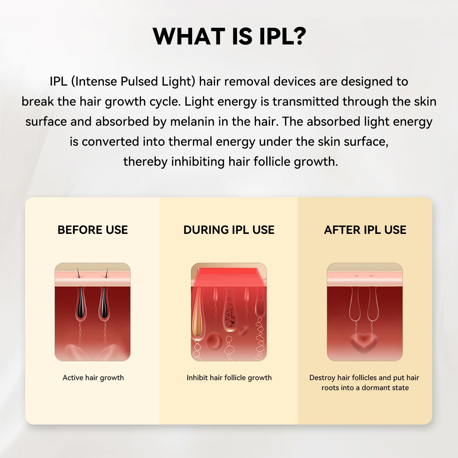 MLAY T14 Urządzenie do depilacji IPL – 96,39% redukcja włosów po 4 tygodniach, 5 milionów błysków, Bezbolesne z systemem chłodzenia (brak lasera), dla wszystkich typów skóry (czerwony)