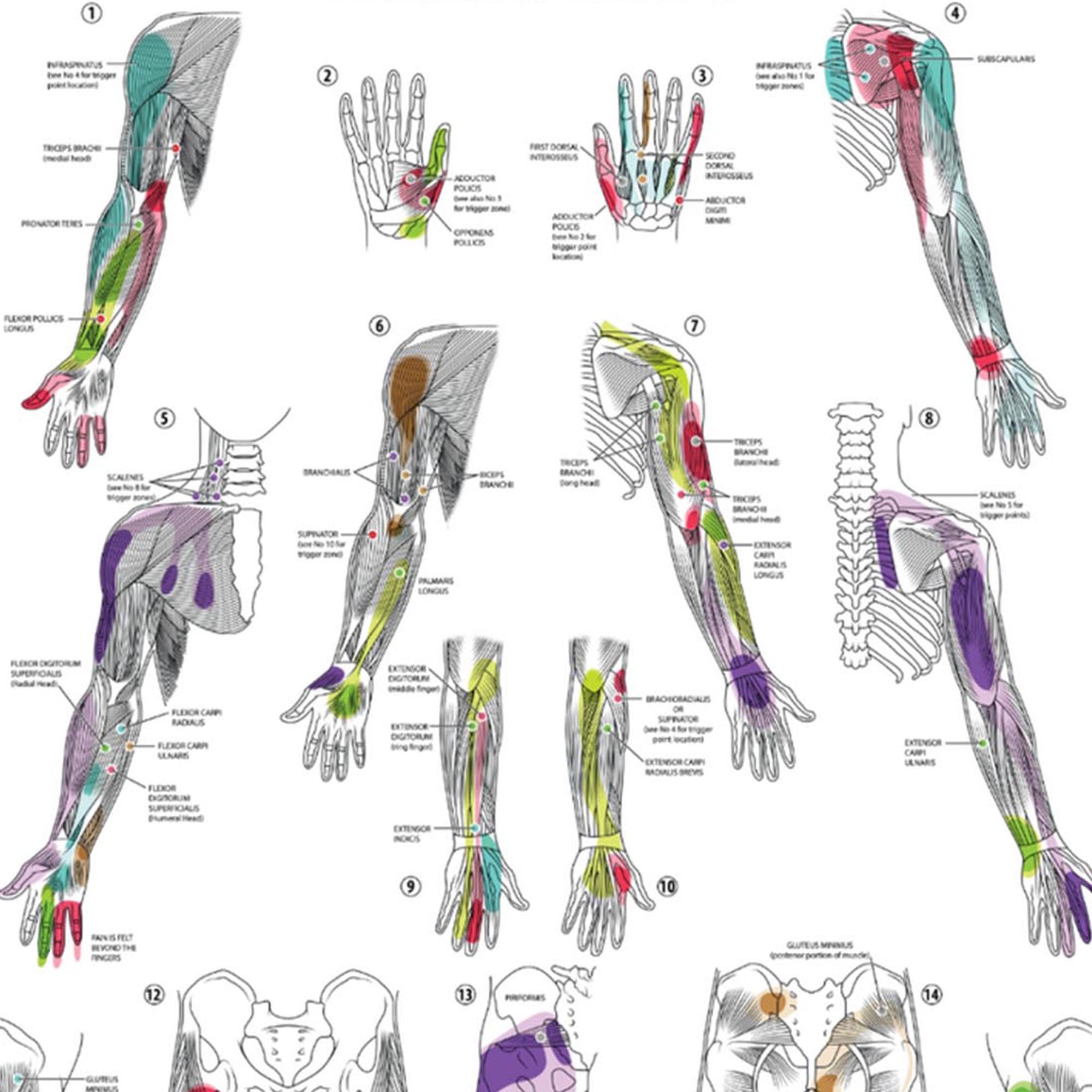 Anatomy Lab Trigger Points II Poster, LAMINATED, Anatomy and Physiology Trigger Points Poster, 17.3 x 22.5 Inches, Trigger Points Anatomy Poster