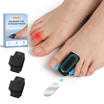 Hammer Toe Straightener Corrector - 2 Pcs Hammer Toe Corrector For Women & Men, Toe Splints & Wraps Support For Hammer, Curled, Bent Toes - Toe Corrector - Black