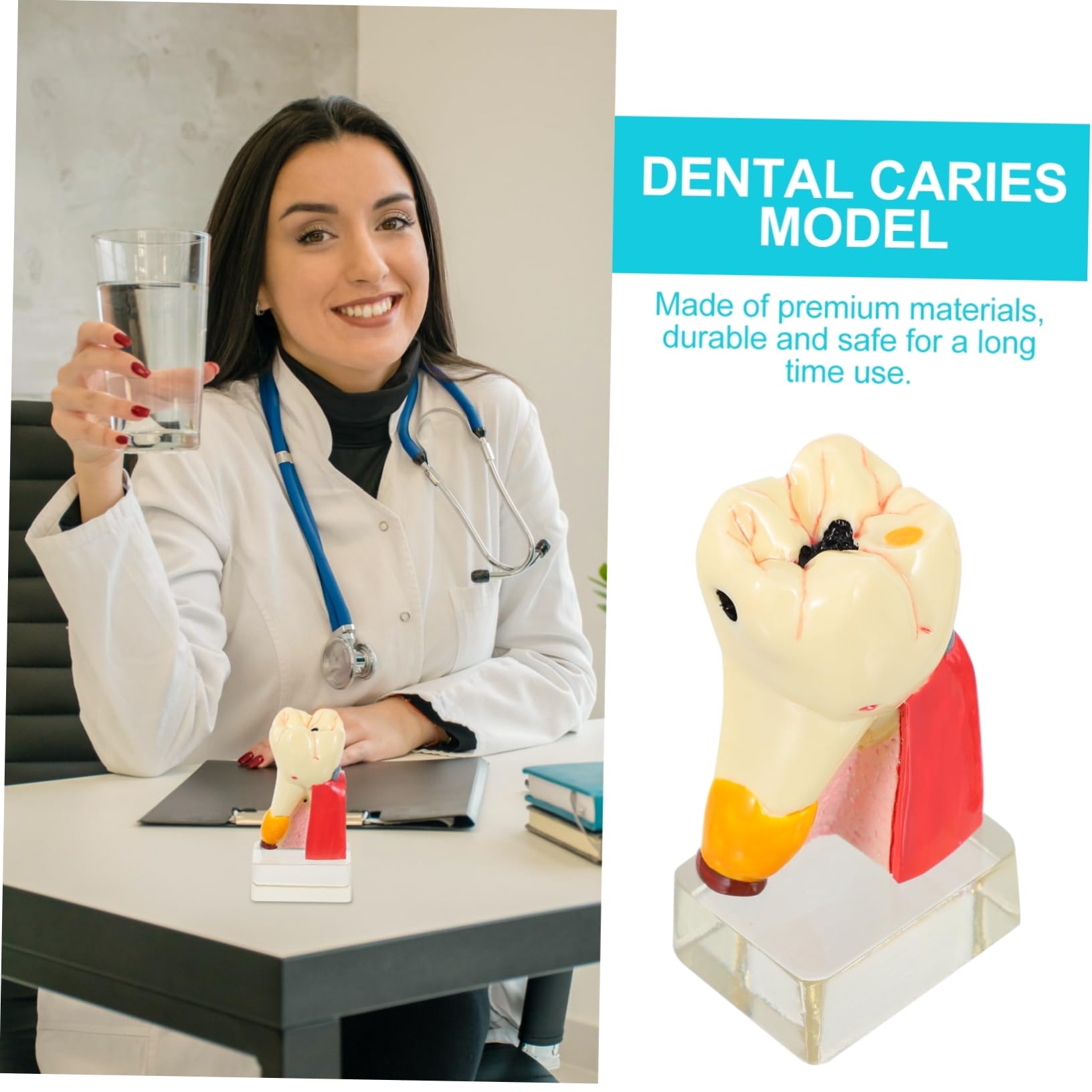 4volte Modello Anatomico di Carie per Studi Odontoiatrici Strumento Didattico per Insegnamento e Dimostrazioni Realizzato in Materiale