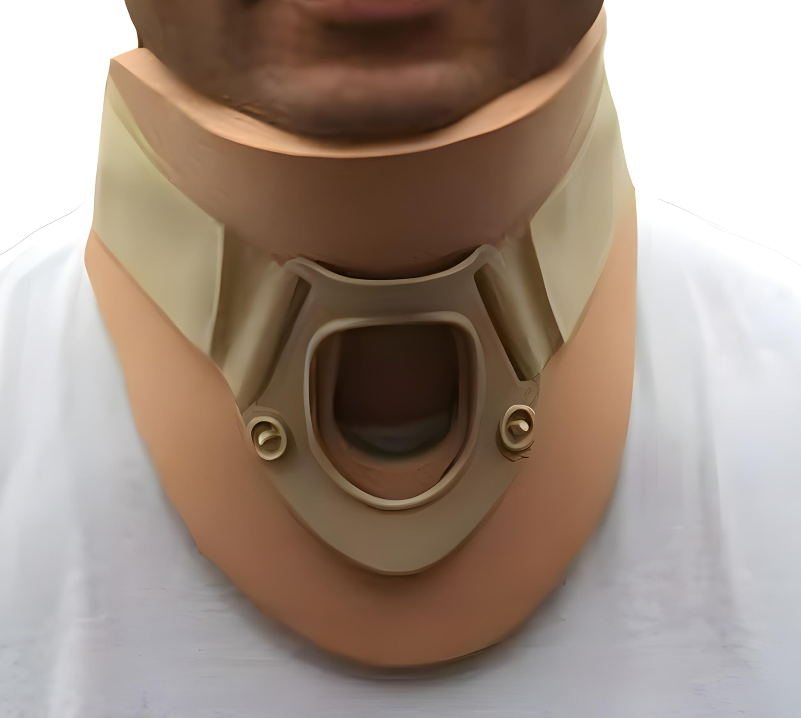 Alpha Medical Universal Philadelphia Cervical Neck Support Collar - Adjustable, Firm Foam Neck Brace with Tracheostomy Opening, Water-Resistant, Ideal for Injury Recovery & Rehabilitation