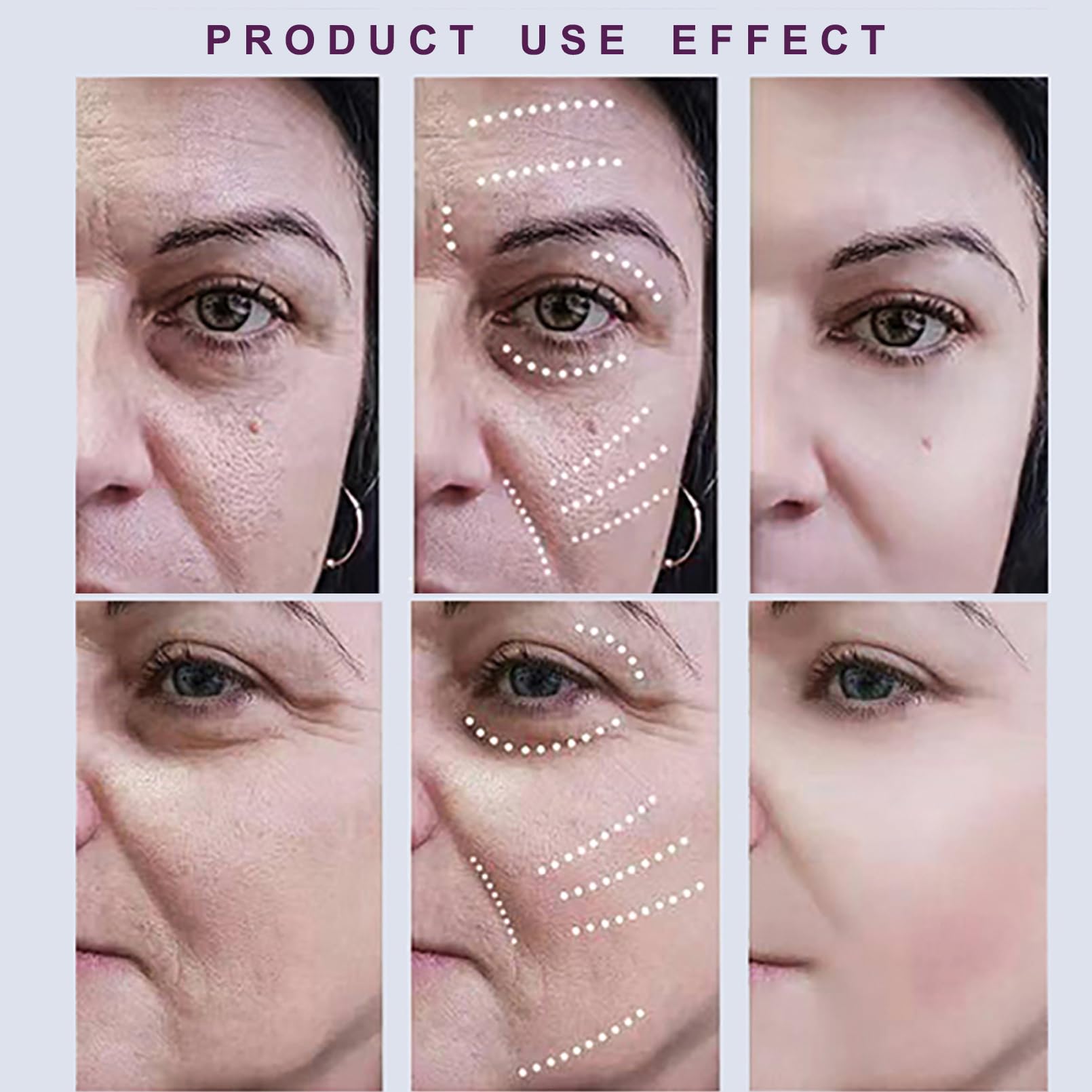 Amazon.com: NexMe Xylane Eye Cream, Pro-Xilane 20g Anti-Aging