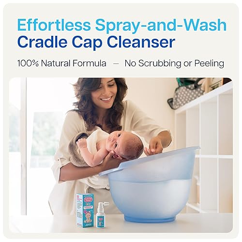 Miniatura 2 de NAVEH PHARMA Limpiador de tapa de cuna para bebés y niños  Tratamiento de tapa de cuna 100% natural  Spray y lavado sin fregar  Mejor que el champú