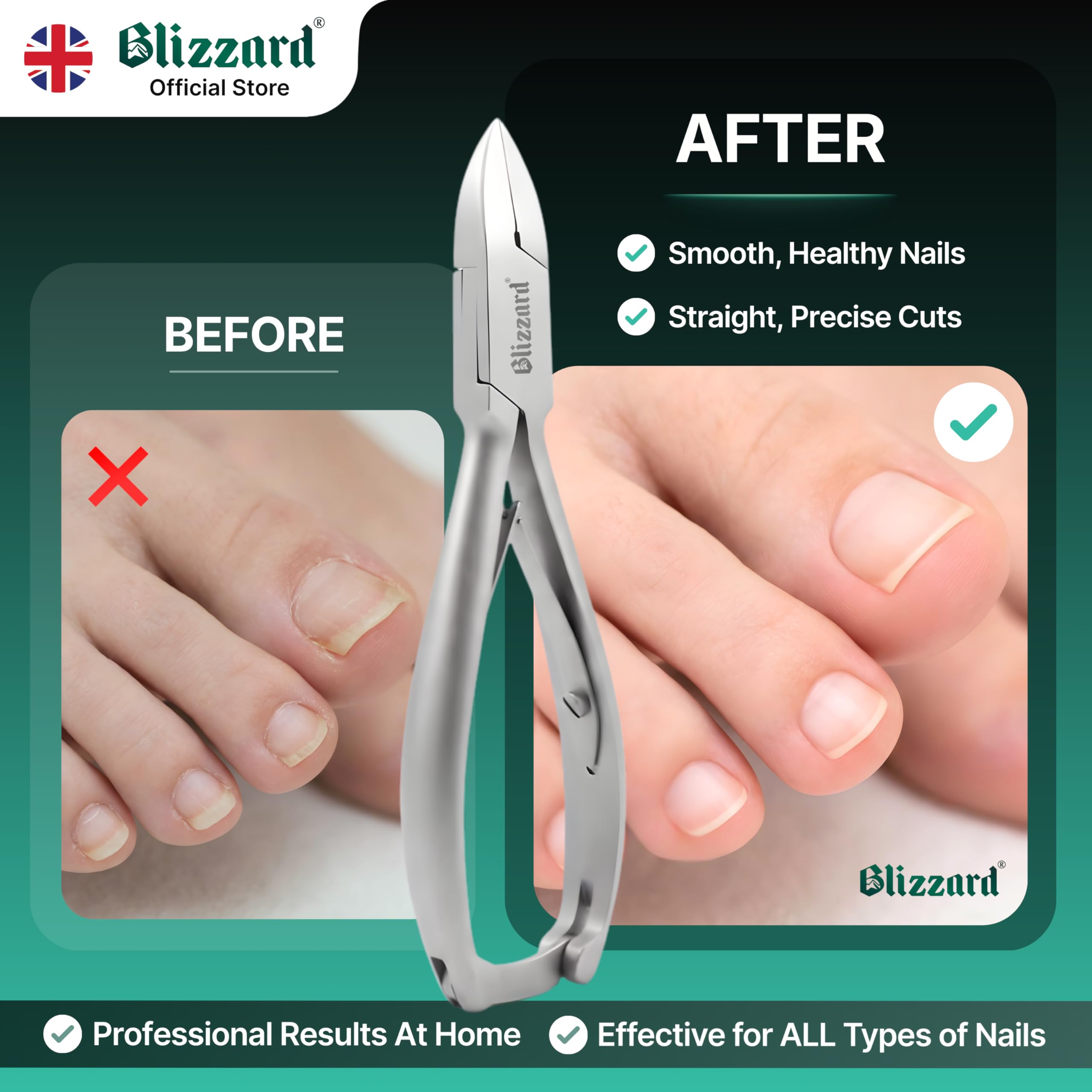Blizzard Podología Cortauñas De Pies - Profesional Pedicura Cortador Con Mangos Suaves -14.5cm Alemán Acero Inoxidable s - CE Aprobado Cortauñas De Pies