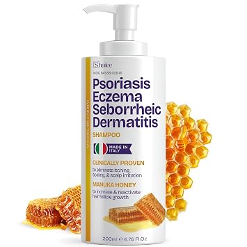 Psoriasis Shampoo for Eczema, and Folliculitis Treatment - Seborrheic Dermatitis Antifungal Shampoo for Ringworm, Acne, Flaking, Dry & Itchy Scalp Treatment - Psoriasis Relief with Manuka Honey