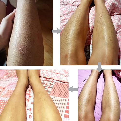 Miniatura 6 de Dr.Deep Real Body Lotion 10.6 onzas líquidas | Crema corporal natural para piel seca | Crema hidratante para piel seca | Crema hidratante reparadora