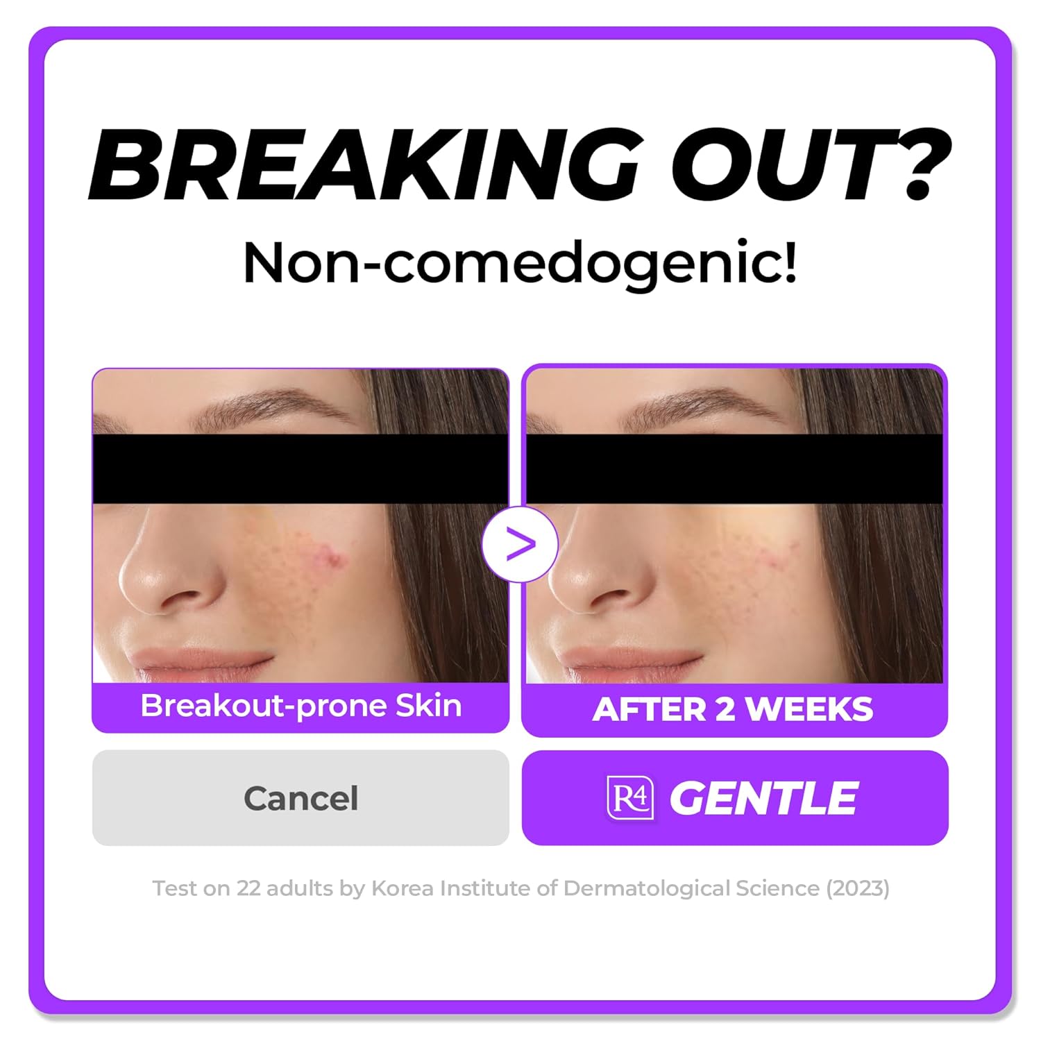 Dermafirm Soothing Repair Korean Emulsion Cream R4 | Daily Face Moisturizer Skin Care Emulsion with Eucalyptus, Peptide and Collagen | Gentle for All Skin Types No Animal Trials No Paraben 6.76 fl oz - Image 4