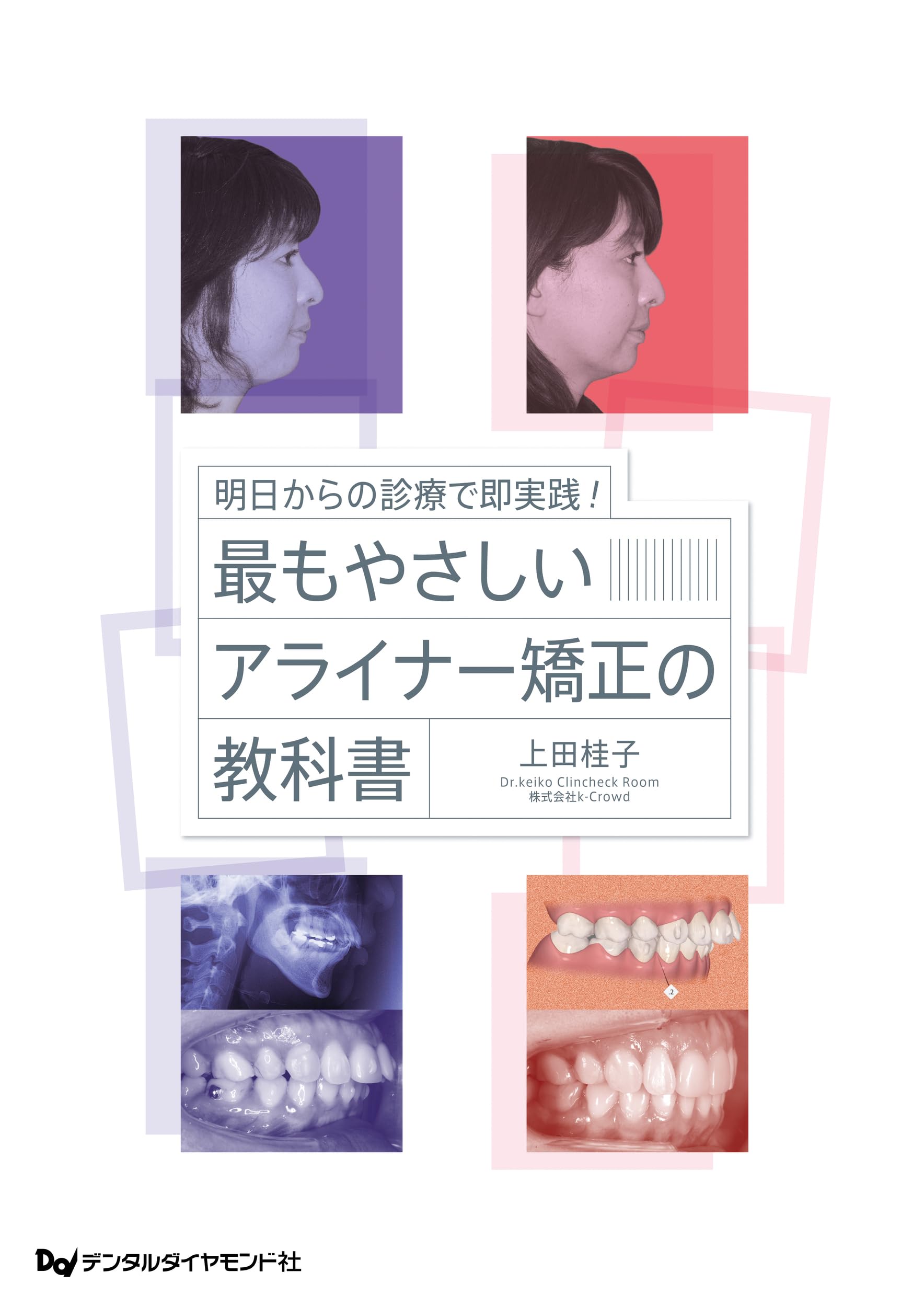Amazon.co.jp: 明日からの診療で即実践! 最もやさしいアライナー矯正の