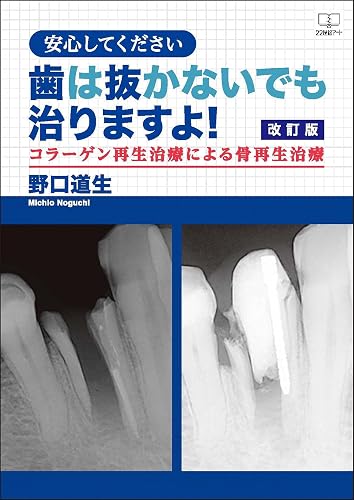 Revised version Please be assured that you can heal without removing your teeth Bone regeneration treatment by collagen regeneration treatment (Japanese Edition)