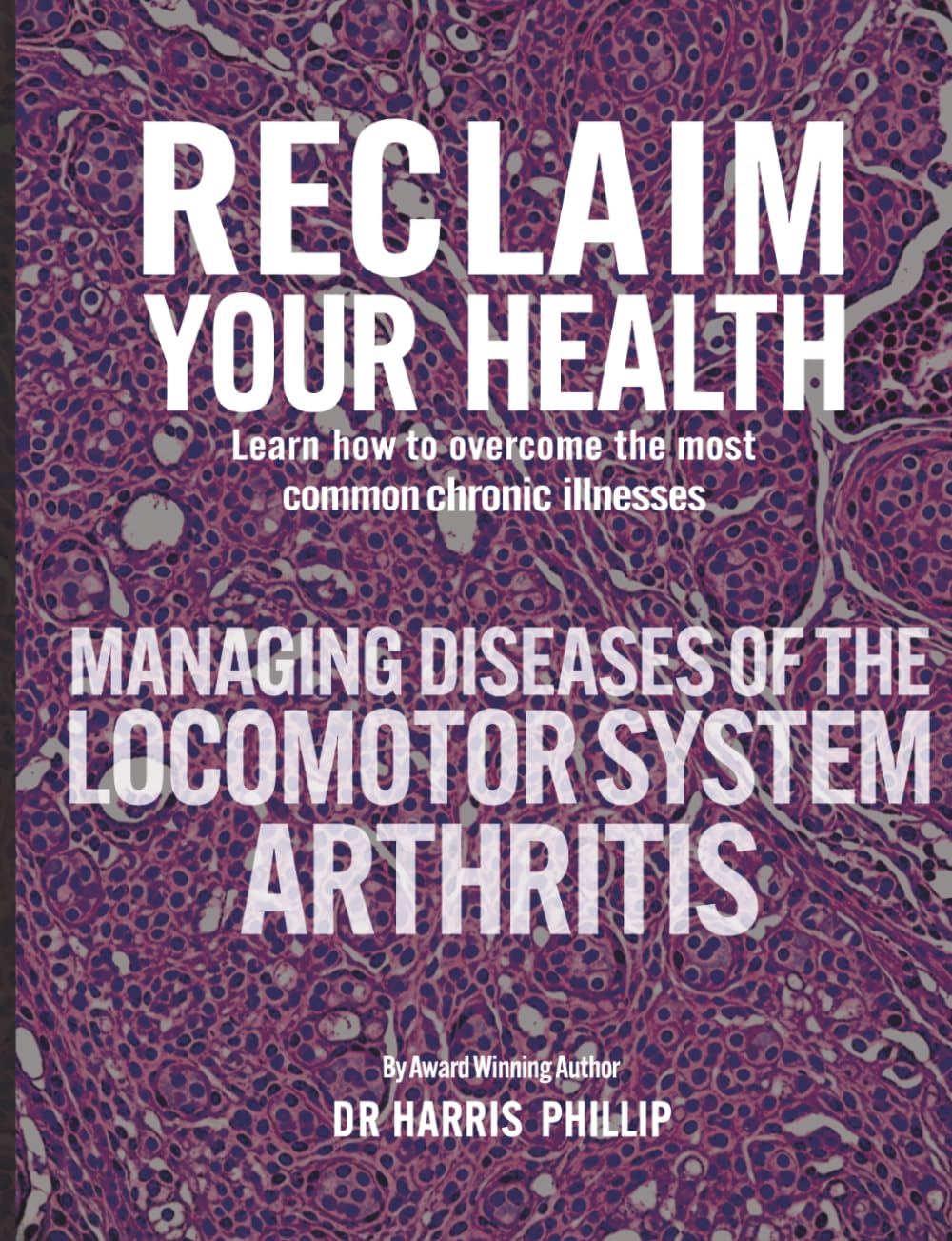 RECLAIM YOUR HEALTH - MANAGING DISEASES OF THE LOCOMOTOR SYSTEM - ARTHRITIS: Learn how to overcome the most common chronic illnesses: 8