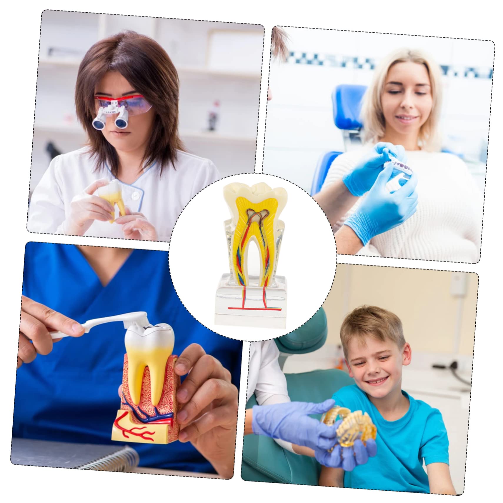 PRETYZOOM 6volte Modello Di Denti Dentali Modello Di Studio Per Per Lezioni Di Odontoiatria Dimostrazione Di Impianto e Protesi Fissa