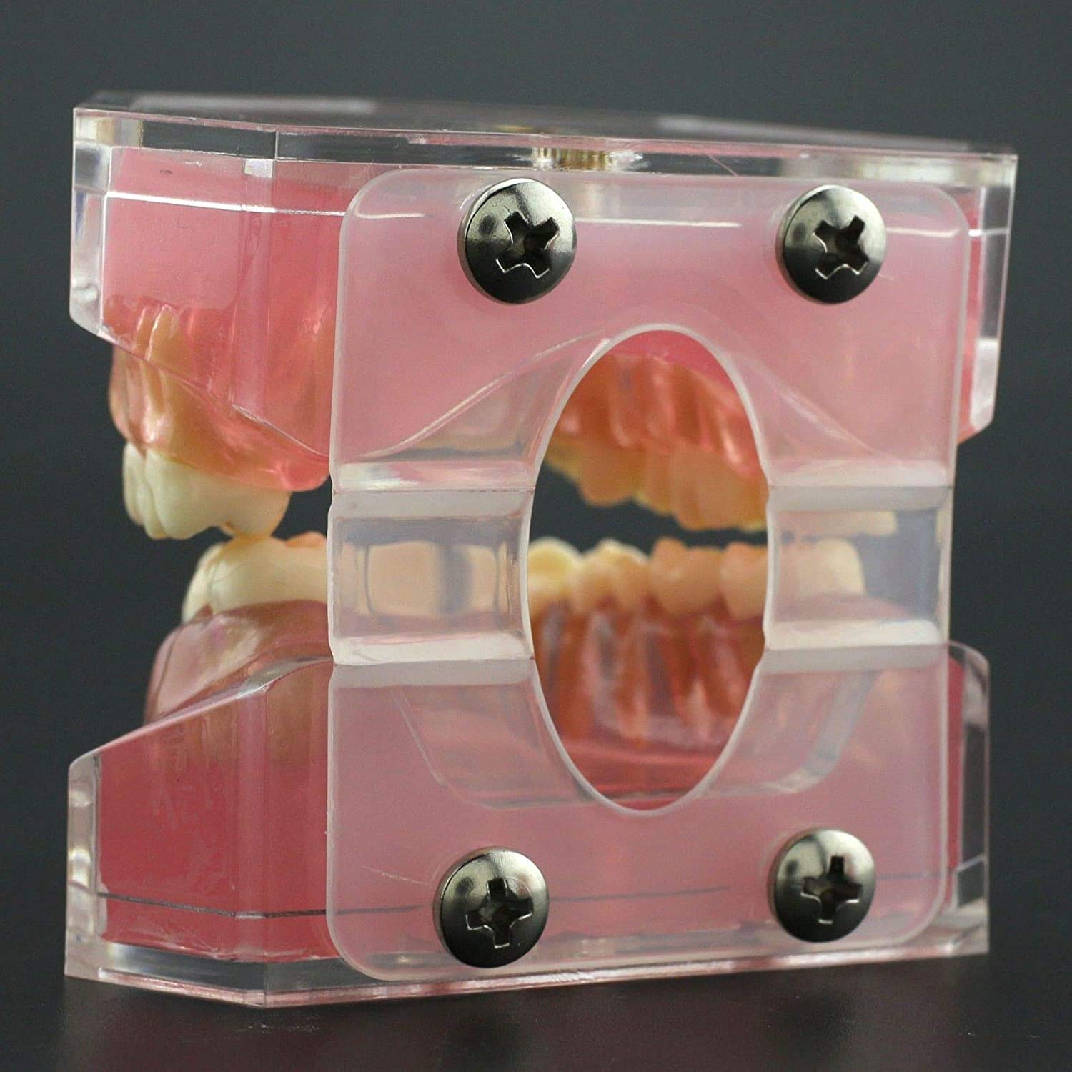 Modello di Denti, Gengive Morbide Smontaggio Completo, Estrazione Dentale Completa per L'odontoiatria O Il Dentista con Pazienti