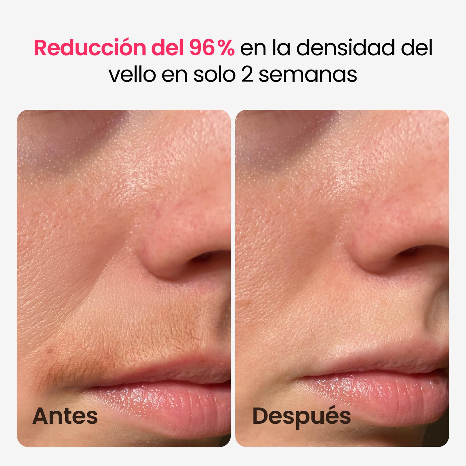 25J Depiladora Laser, Depiladora Luz Pulsada Mujer Hombre con TRIPLE-Pulso, 12 cm² Indolora Zafiro 3℃ Hielo Enfriamiento, Depilación Permanente para Cara, Axilas, Bikini, Cuerpo, Alternativa al Salón