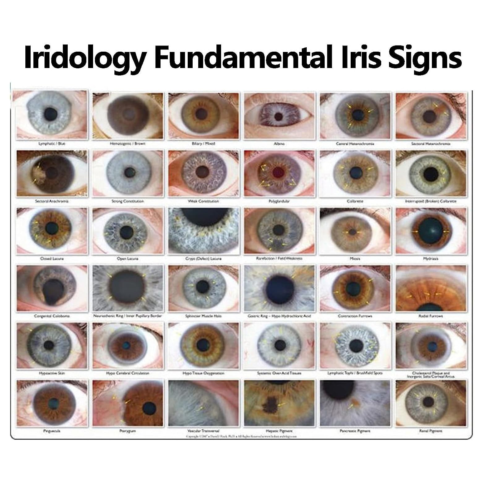 CaméRa Iridoscope MéDicale, Analyseur Iris + Iridoscope Usb + CaméRa Iridologie + Logiciel Pro Iris Eye Diagnosis, Compatible Avec Windows 10, 8, 7, Xp, Vista,Manually
