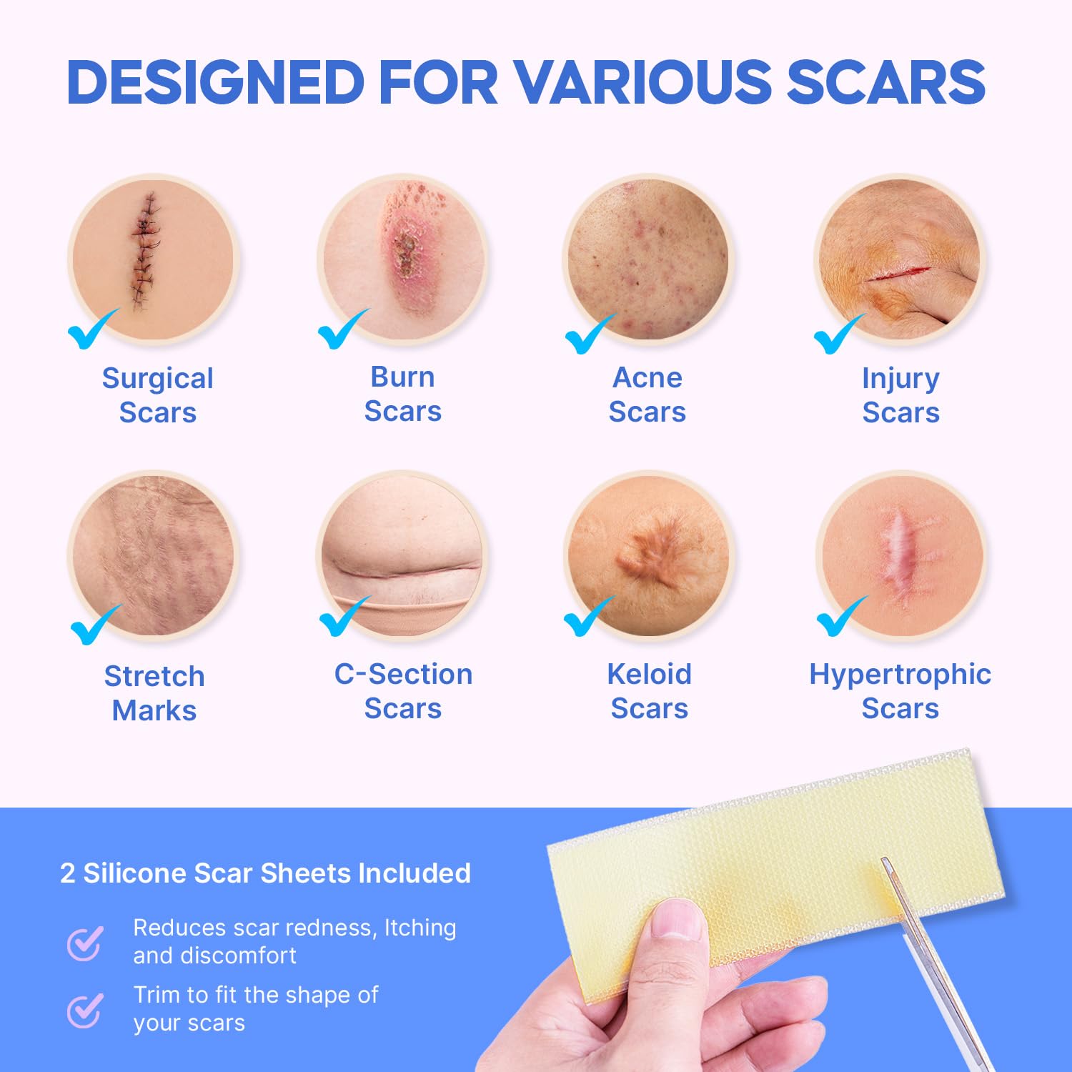 Medical Grade Silicone Scar Gel: Old and New Scars Removal Cream - Intensive Fade Surgical & C-Section Scars, Stretch & Acne Marks, Injury, Burns, Keloids, 30g, 2 Scar Sheets - Image 3