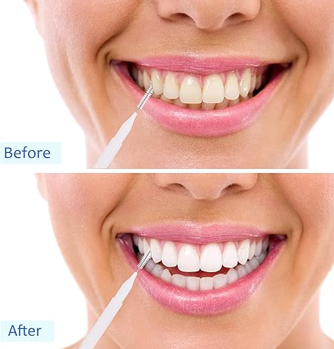 Miniatura 65 de Patelai 100 piezas de cepillos para limpiador, cepillo interdental, palillo de dientes, cabezal de hilo dental, hilo dental, higiene dental, hilo