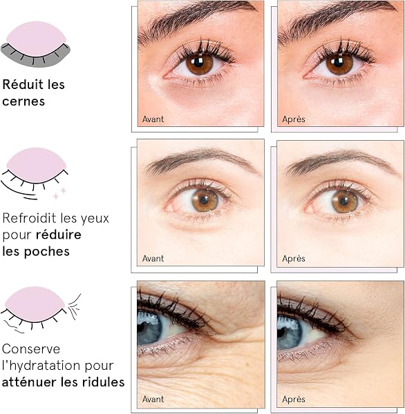 Grace & Stella - Award-winning Eye Mask [6 Pairs, Blue] Eye Patch Anti Dark Circles Gel - Reduces Dark Circles Under the Eyes, Anti Pocket - Vegan & Cruelty-Free - 3