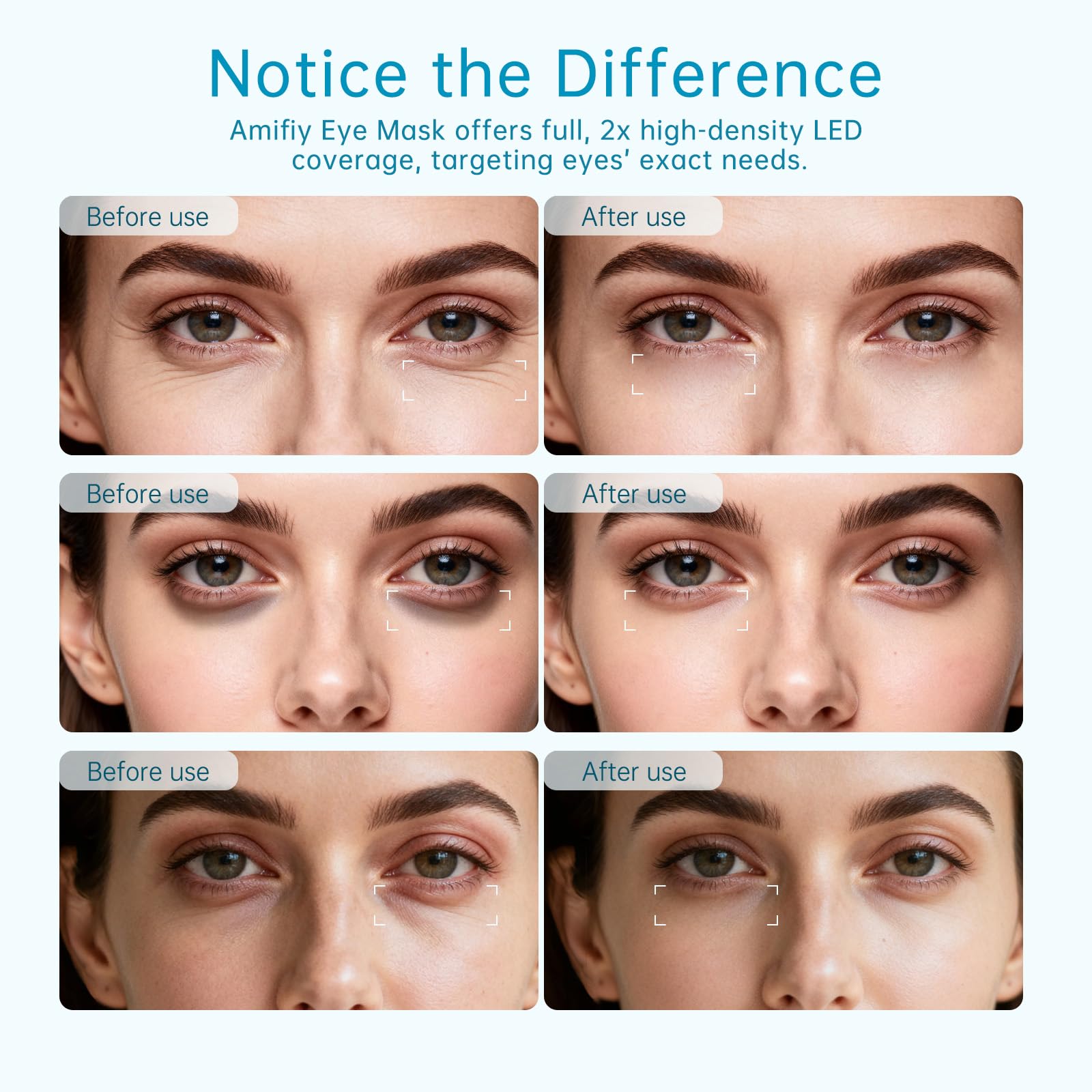Rotlichttherapie für Augen, 3 Minuten NIR Rotlicht-Augenmaske reduziert Augenringe unter den Augen, Tränensäcke, geschwollene Augen, Falten, Infrarot-LED-Augenmaske, Anti-Aging-Gerät für Frauen