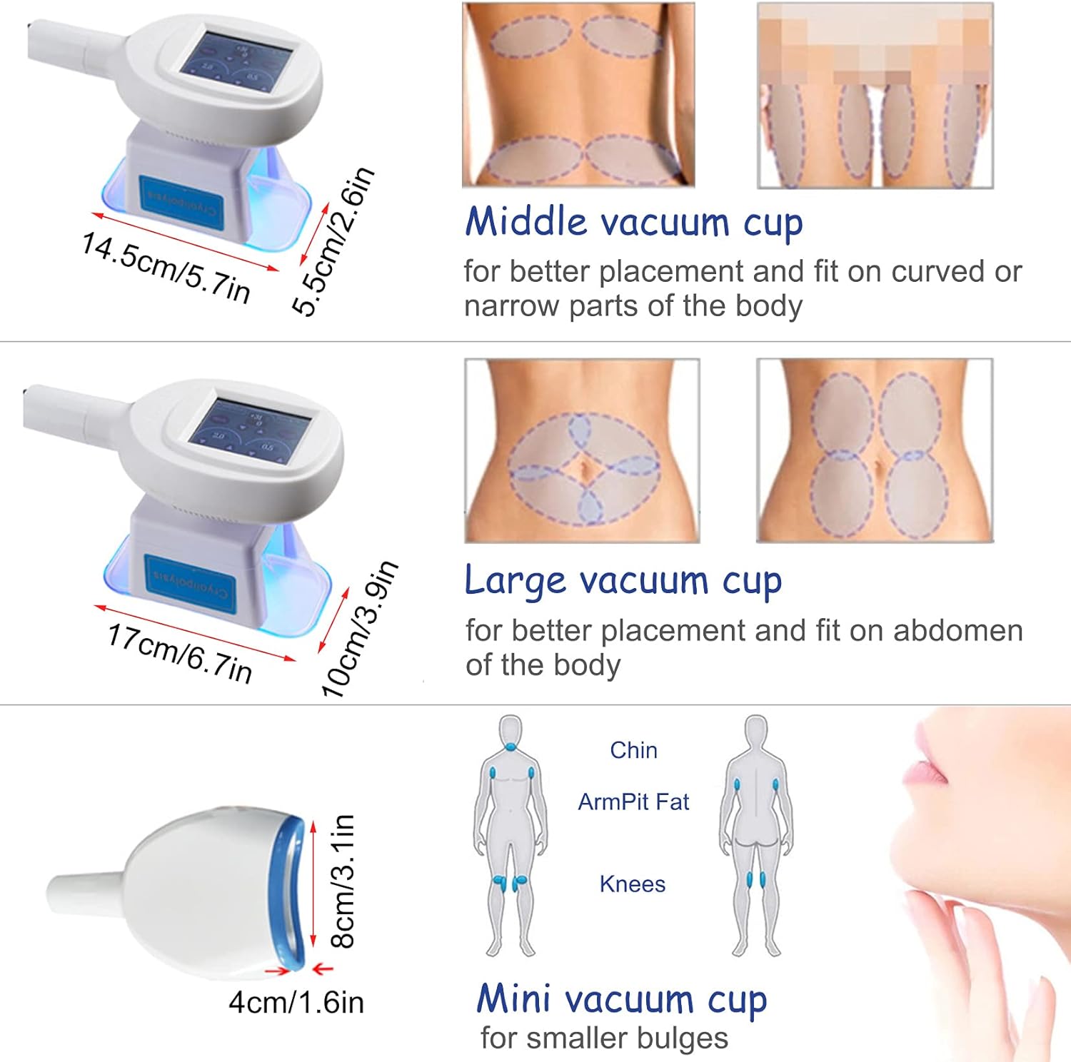 Image showing different sizes of vacuum cups and their target body areas