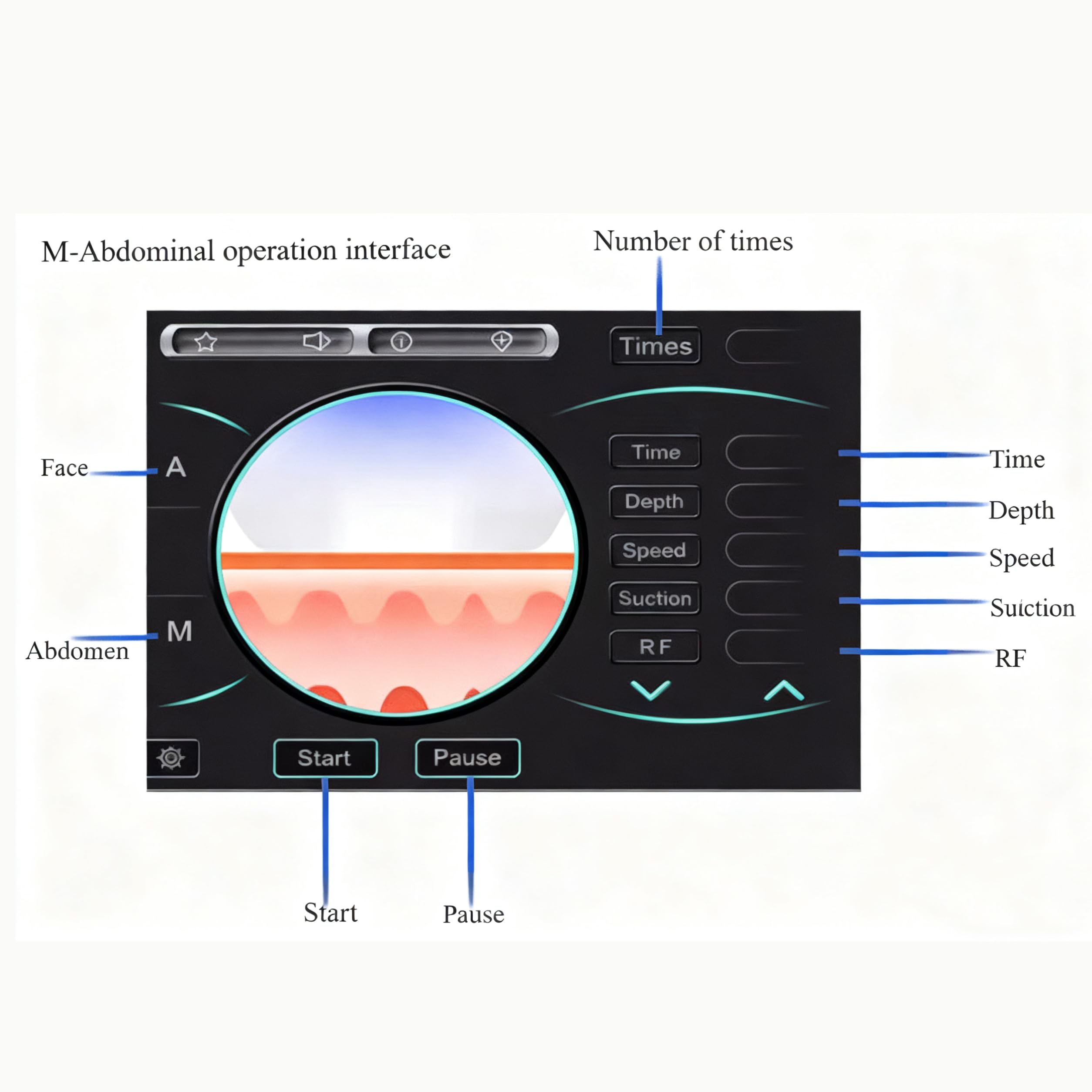 RadiofréQuence Faciale Corporelle Appareil de microneedling pour le visage et le corps, dispositif de raffermissement cutané avec 2 poignées pour la réduction des rides et l'atténuation des