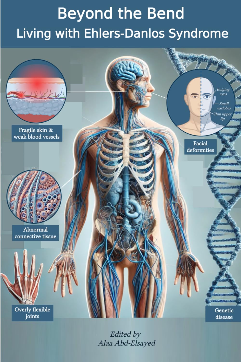 Beyond the Bend: Living with Ehlers-Danlos Syndrome