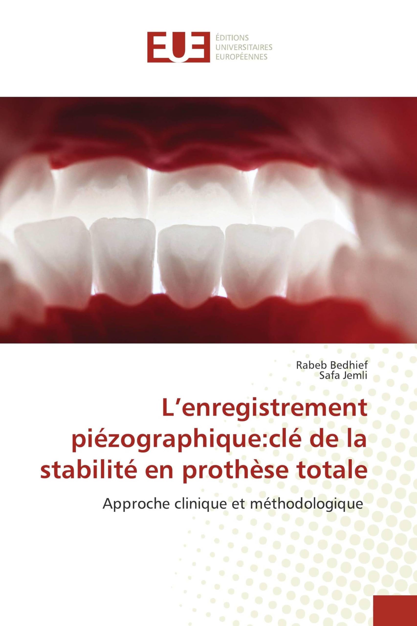 L'enregistrement piézographique: clé de la stabilité en prothèse totale