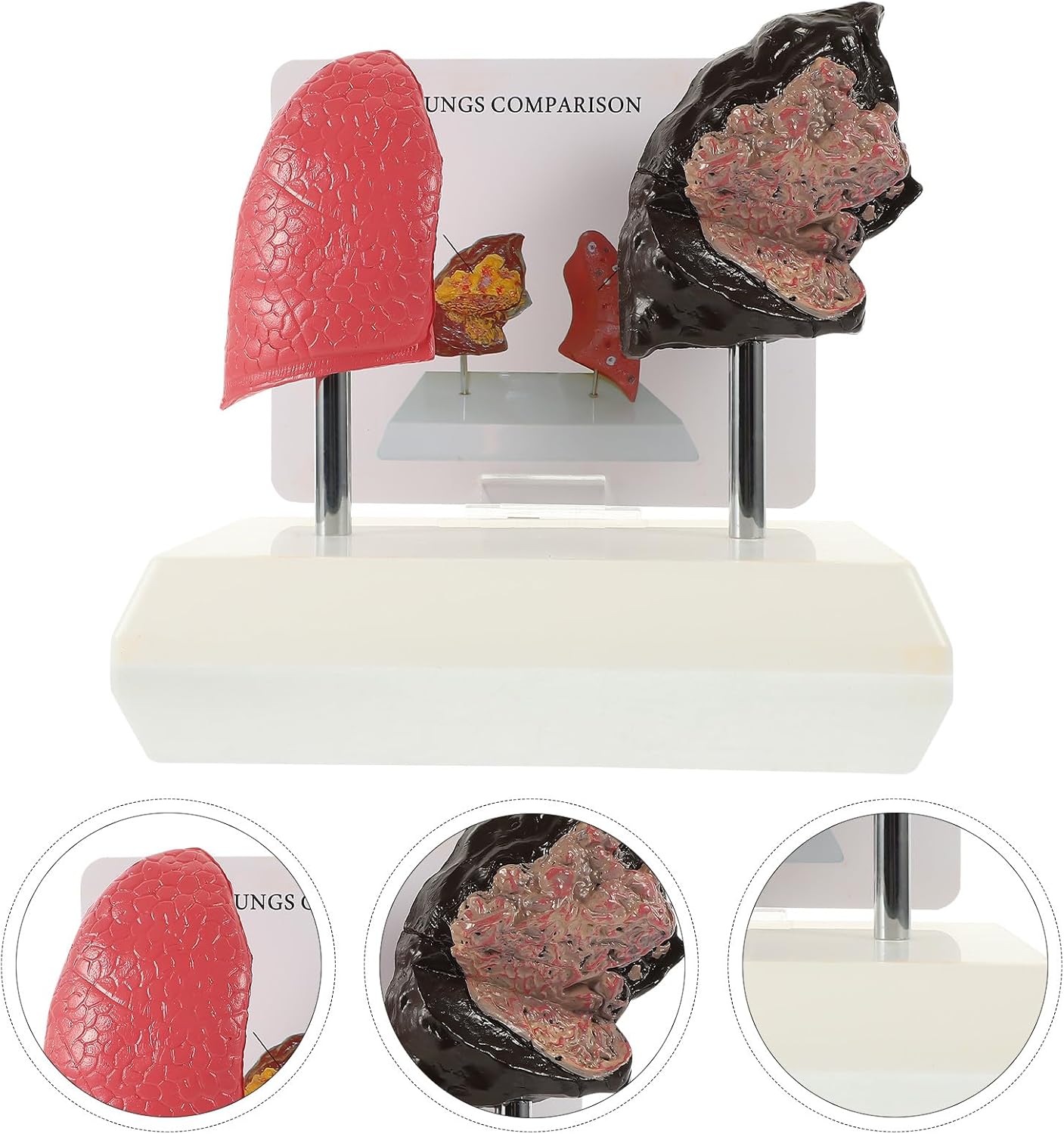 RUNROTOO Smoking Lung Model and Normal Lung Comparison Realistic PVC Anatomy Model for Medical Teaching and Health Education Palpable Texture