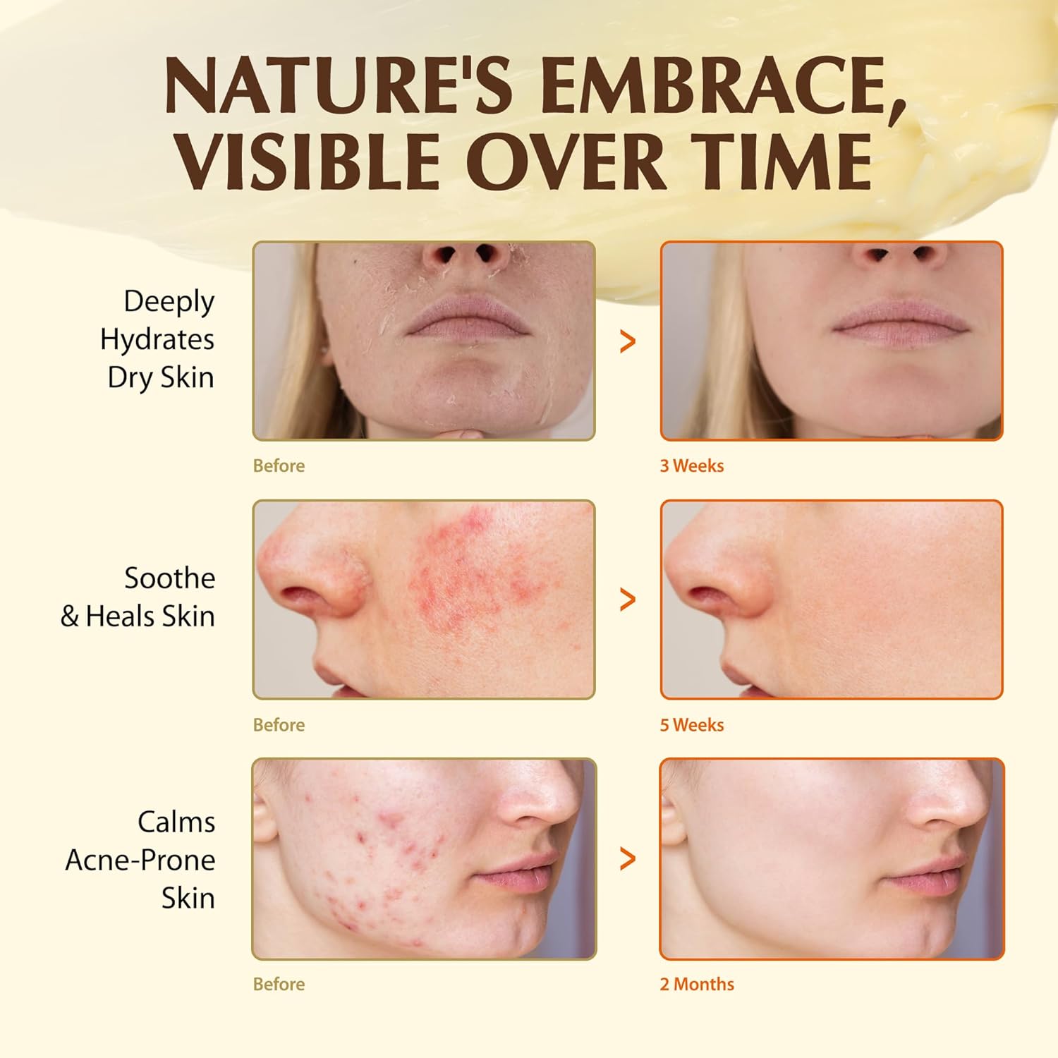 Beef Tallow Sunscreen & Nourishing Balm Duo: SPF 50 Mineral Zinc Sunblock with Grass-Fed Tallow & Organic Moisturizing Balm Infused with Manuka Honey for Face & Body – Safe for Kids & Sensitive Skin