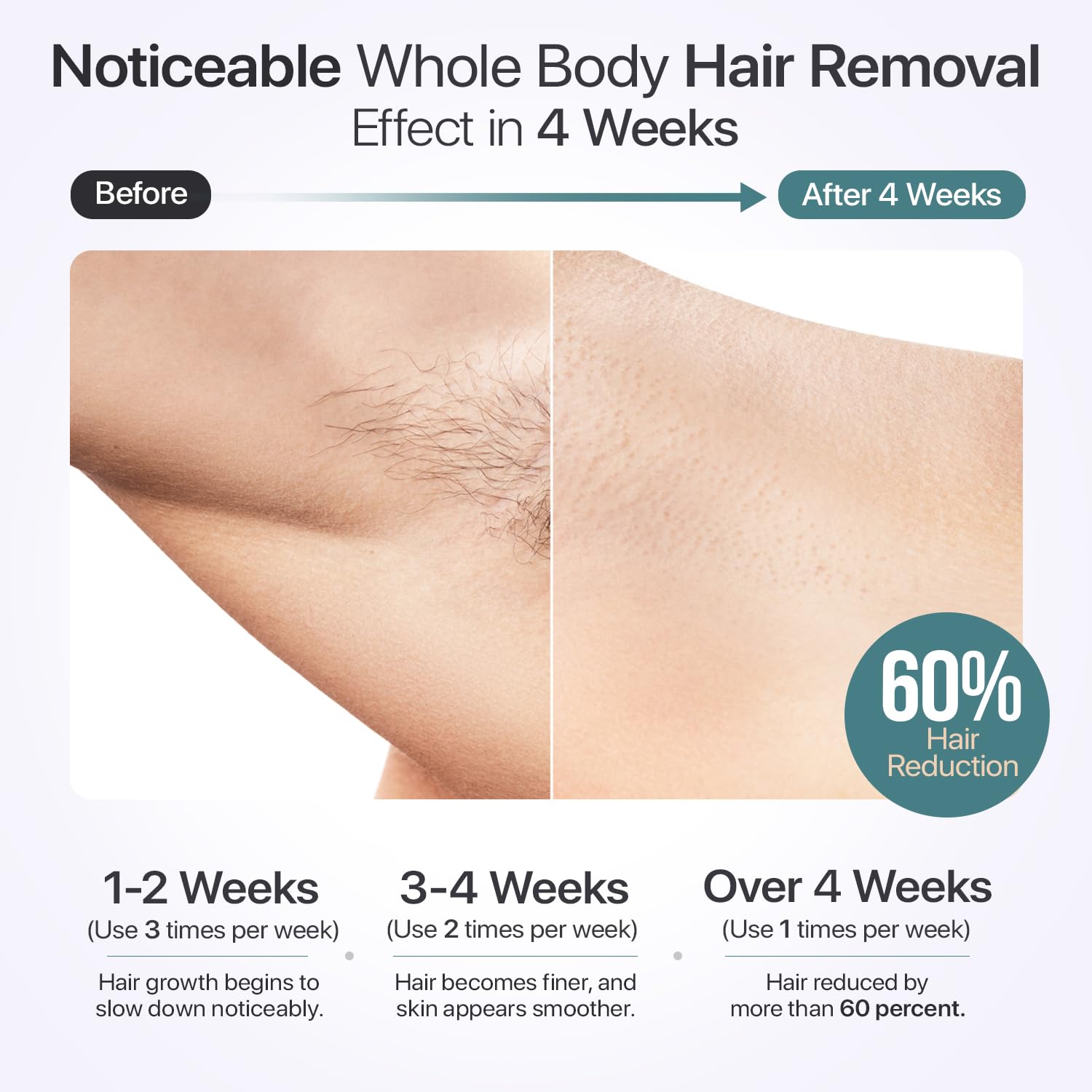 Épilation laser IPL pour homme et femme avec technologie de refroidissement 4,4 °C | Écran LCD 5 modes