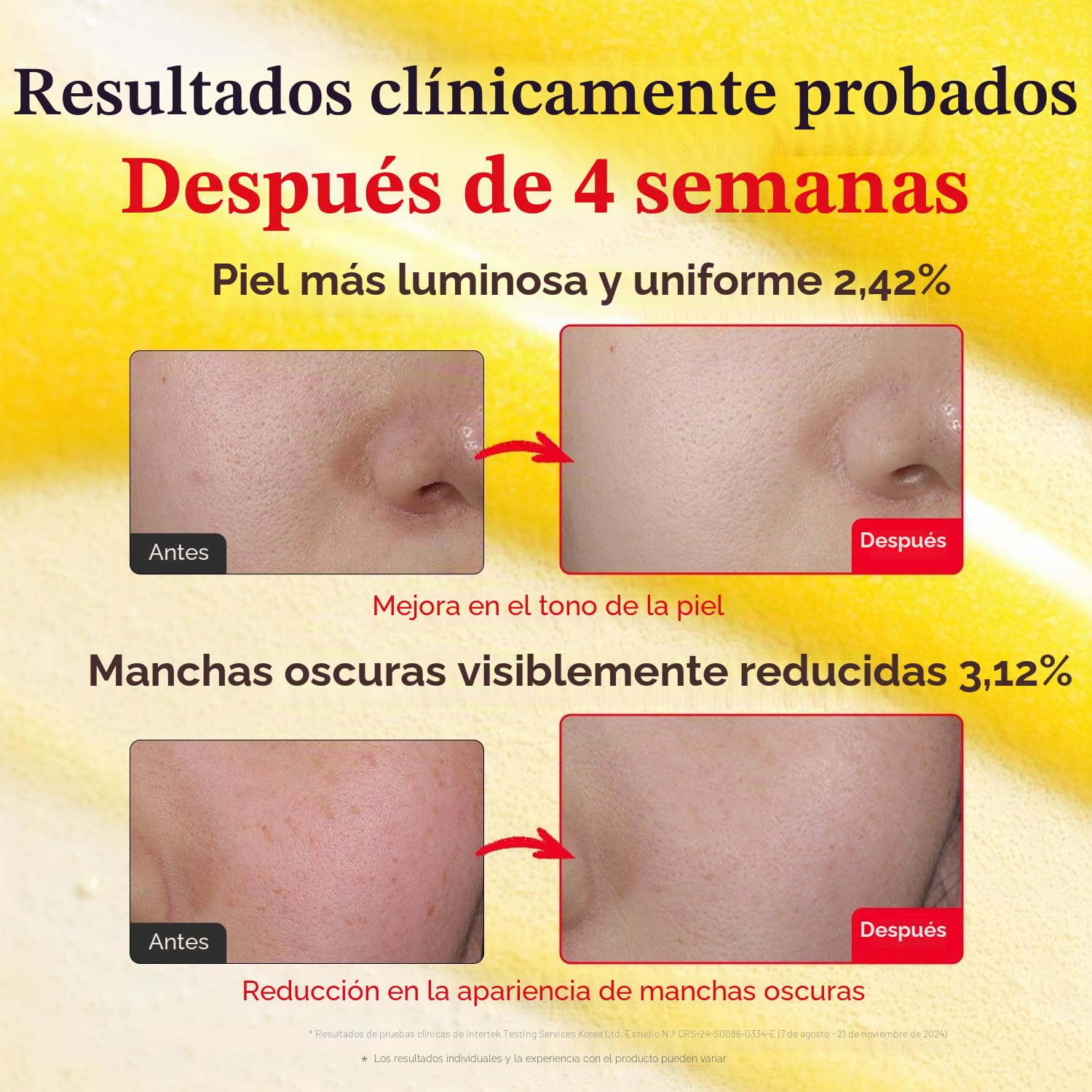EQQUALBERRY Suero Iluminador con Vitaminas – Sérum Facial Ligero con Vitamina C, Niacinamida y Ácido Hialurónico – Hidratación Diaria 30 ml