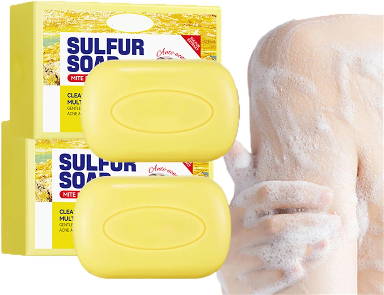Sulfur Soap Bar, Sulfur Cleanser Body Wash, Face Wash Bar Sulfur Cleanser Korean, Sulfur Facial Cleanser Acne Bar Soap for Face, Cleansing Bar Soap with Sulfur for Face and Body (2)
