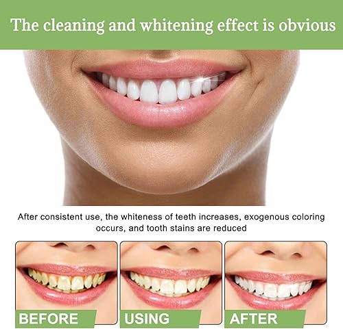 Vista 3 de Paquete de 20 unidades de 3 V de blanqueamiento dental ácido de frutas, pasta de dientes en ampolla, suero de dientes de ampolla, pasta de dientes