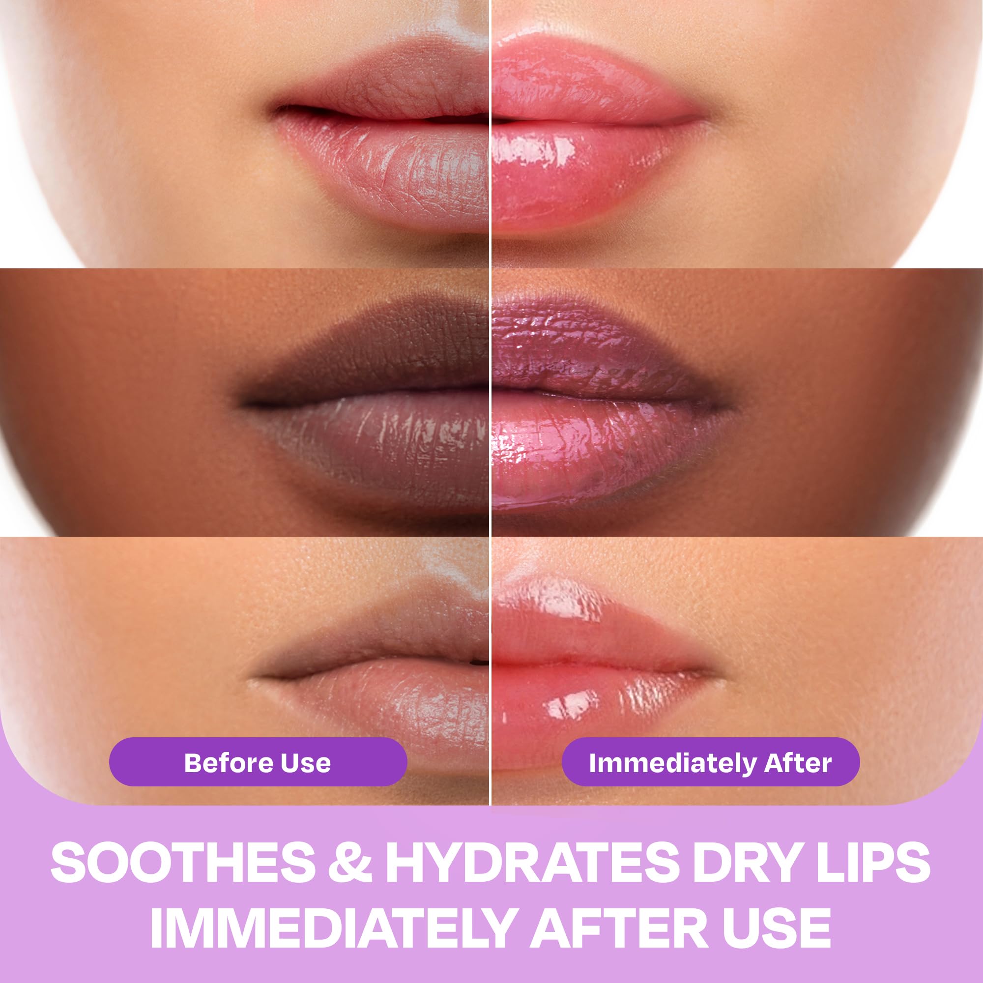 Lip Mask Overnight 30g - Day & Night Lips Balm Hydrating to Soothe Very Dry Lips - Moisturizing Lip Sleeping Mask for Women and Men with Hyaluronic Acid - Bálsamo Hidratante de Labios Care