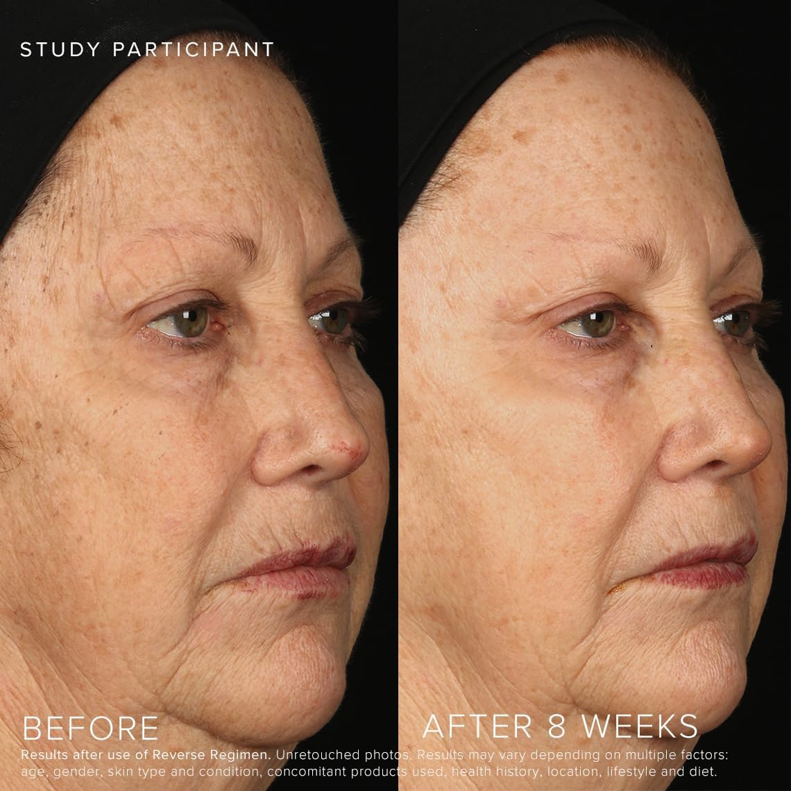 Rodan + Fields Reverse Regimen: Cleanser, Toner, Lotion SPF 50, & Treatment | Daily Moisturizer | Contains Vitamin C & Retinol | Skincare Sets & Kits | Face Wash for Women | Self Care - Image 6