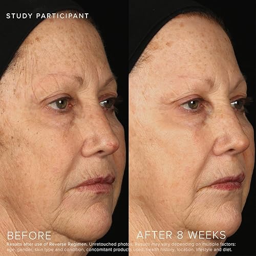 Miniatura 6 de Rodan + Fields Régimen inverso limpiador, tónico, loción SPF 50 y tratamiento  Hidratante diario  Contiene vitamina C y retinol  Juegos y kits de