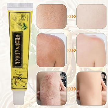 (Effective and Safe) Natural Herbal Moisturisers, East Asian Natural Herbal Body Cream, Skin Relief, for All Skin Types,3pcs