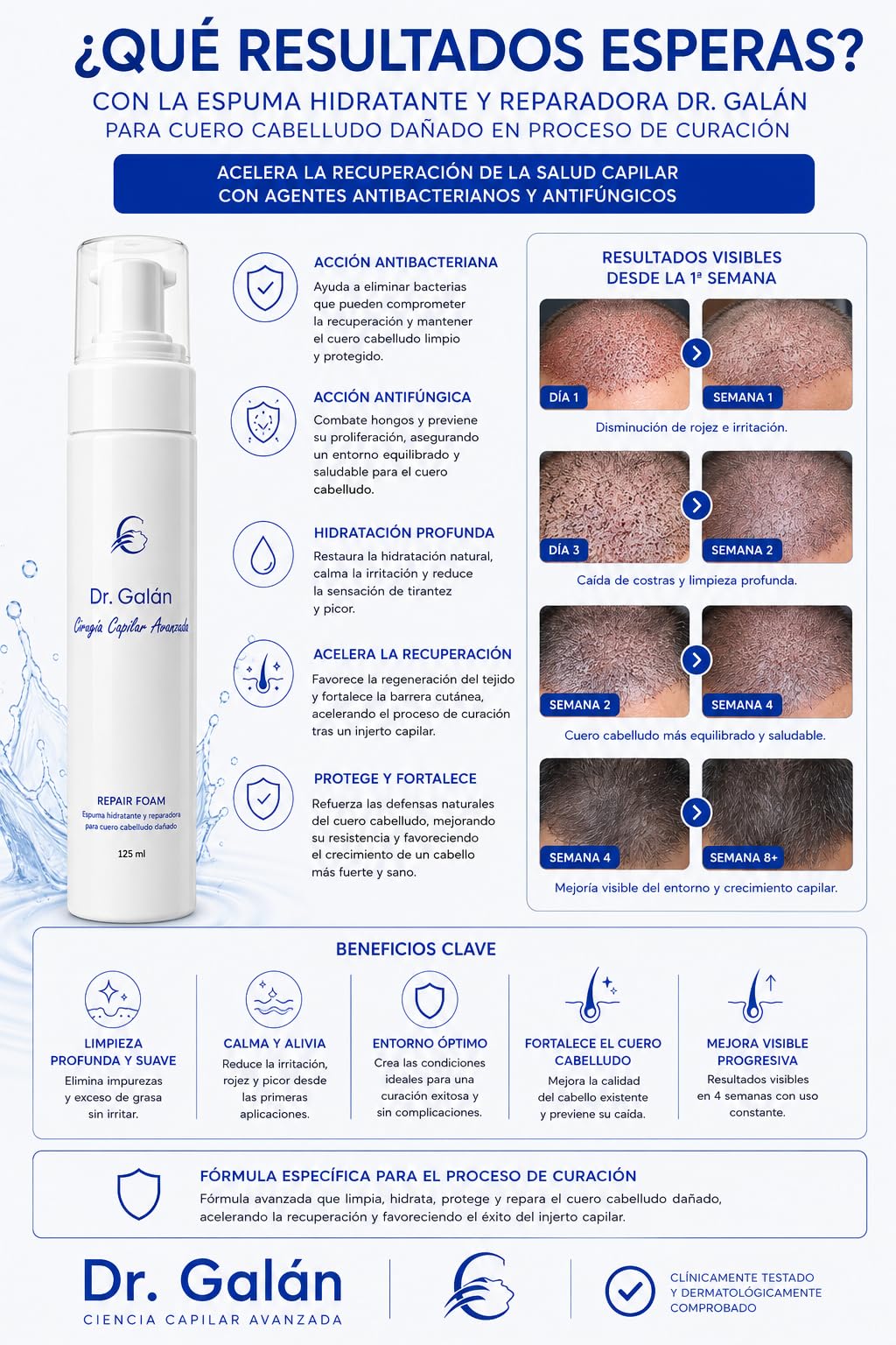 Pack Integral Postcirugía Capilar - Champú Post Injerto, Espuma Reparadora y Spray Calmante para Cuero Cabelludo Dañado - Tratamiento Completo