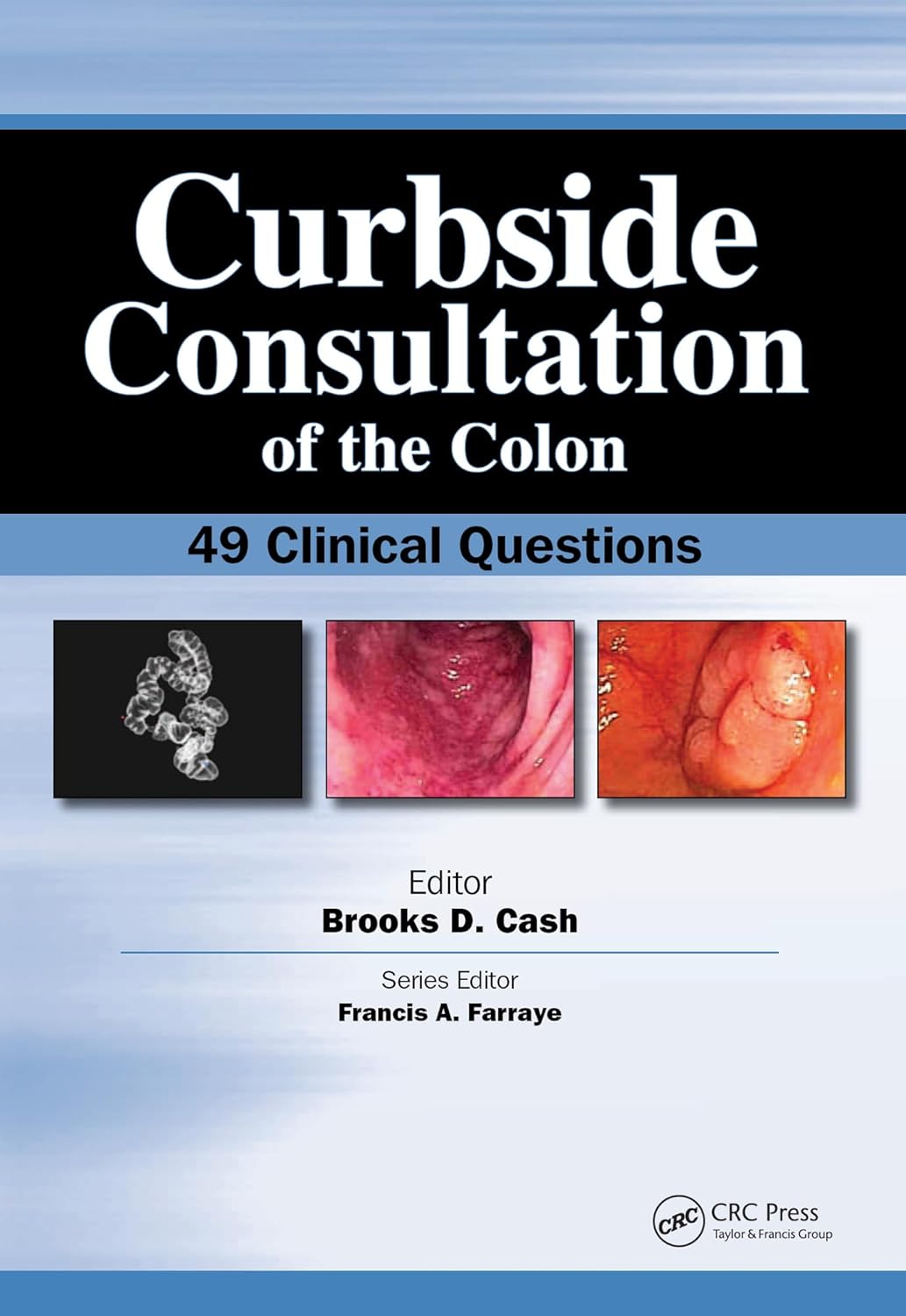 Amazon.com: Curbside Consultation of the Colon: 49 Clinical Questions ...