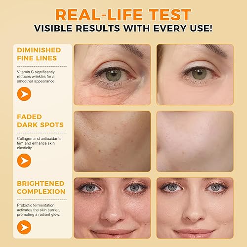 Miniatura 5 de Suero de vitamina C  Suero puro de vitamina C para la cara con ácido hialurónico, vitamina E y ácido ferúlico, suero facial antienvejecimiento para