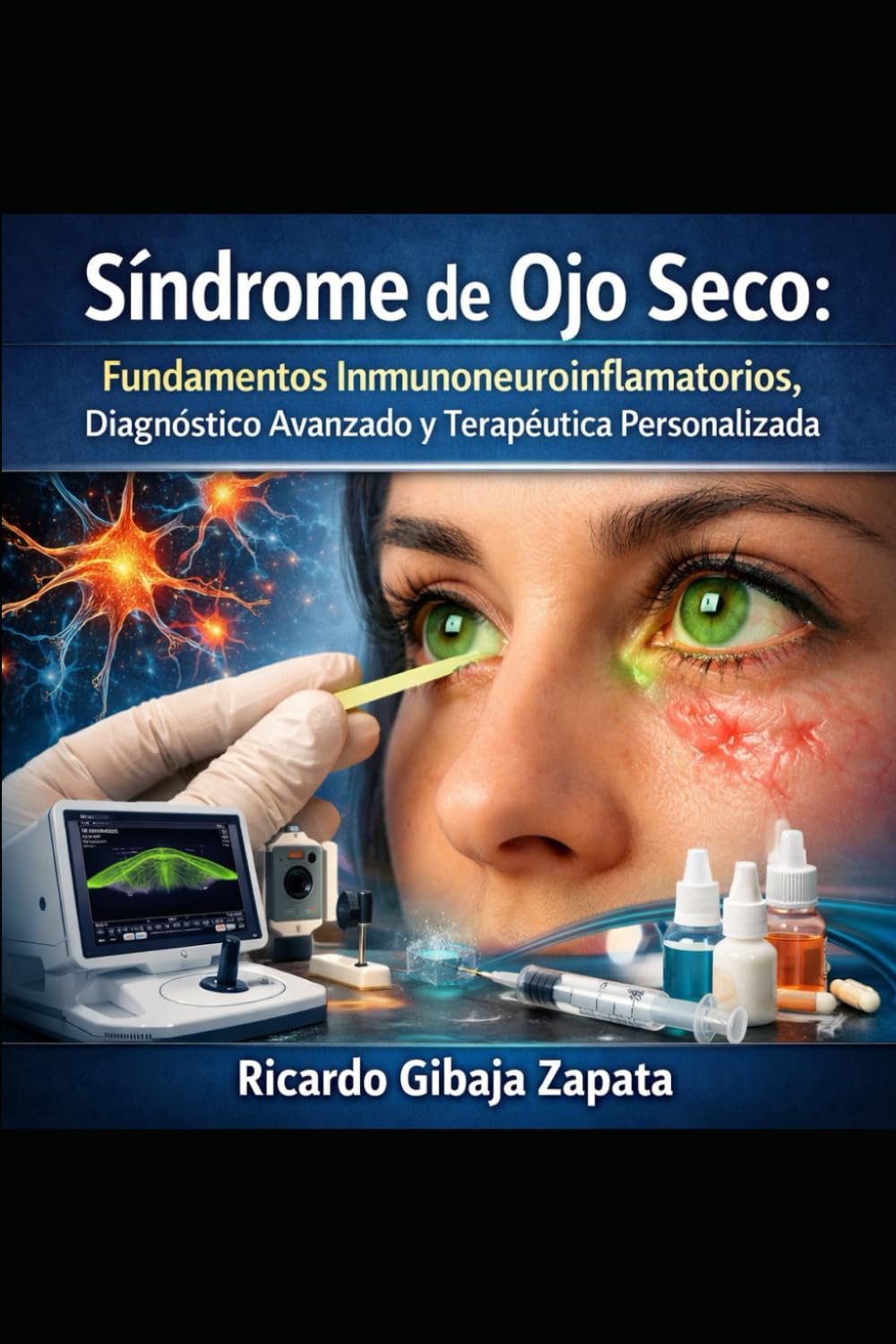 Síndrome de Ojo Seco Fundamentos Inmunoneuroinflamatorios, Diagnóstico Avanzado y Terapéutica Personalizada
