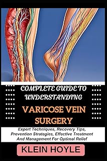 COMPLETE GUIDE TO UNDERSTANDING VARICOSE VEIN SURGERY: Expert Techniques, Recovery Tips, Prevention Strategies, Effective Treatment And Management For Optimal Relief