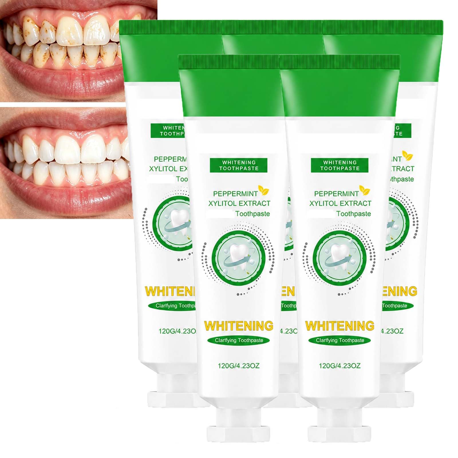 Dentifrice haleine fraîche longue durée, dentifrice blanchissant pour l'élimination des taches, dentifrice pour le nettoyage en profondeur des interstices dentaires, dentifrice pour les soins (5pcs)