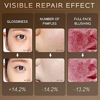 LED近紫外線マスク Amazon.com : L E D Face Mask Light Therapy