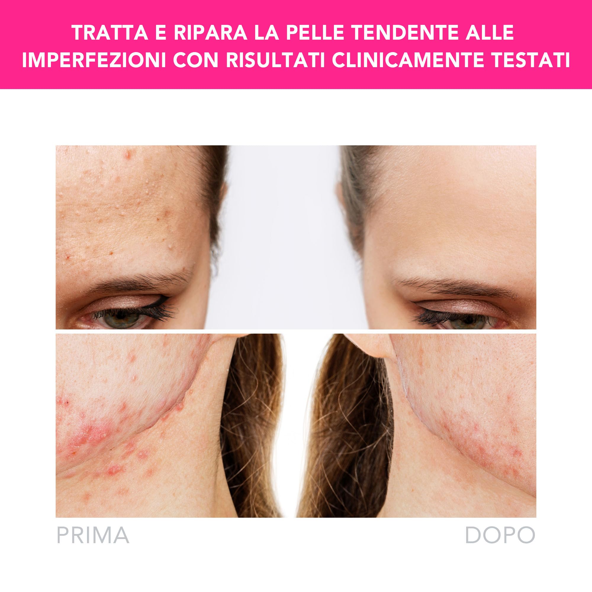 Foreo Espada 2, Terapia a Luce LED, Dispositivo di Skincare Anti-Acne a Luce Pulsata- Silicone Medico, Trattamento Viso per Cicatrici, per Brufoli e Macchie Viso, Approvato dalla FDA, Fuchsia | Dispositivo LED, luce blu, rimuovi-imperfezioni, brufoli, app
