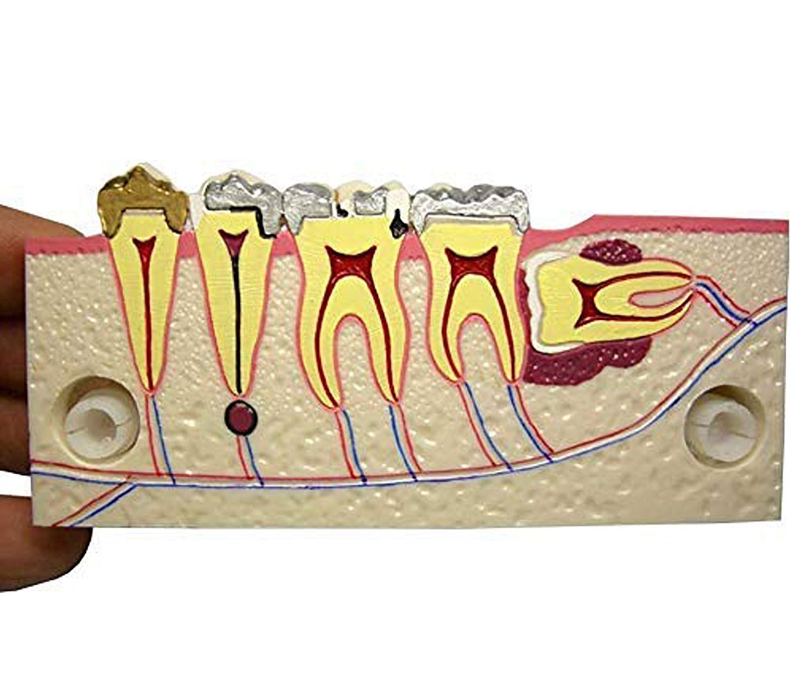 Modèle anatomique de dents pour réviser les examens d'implants - 15
