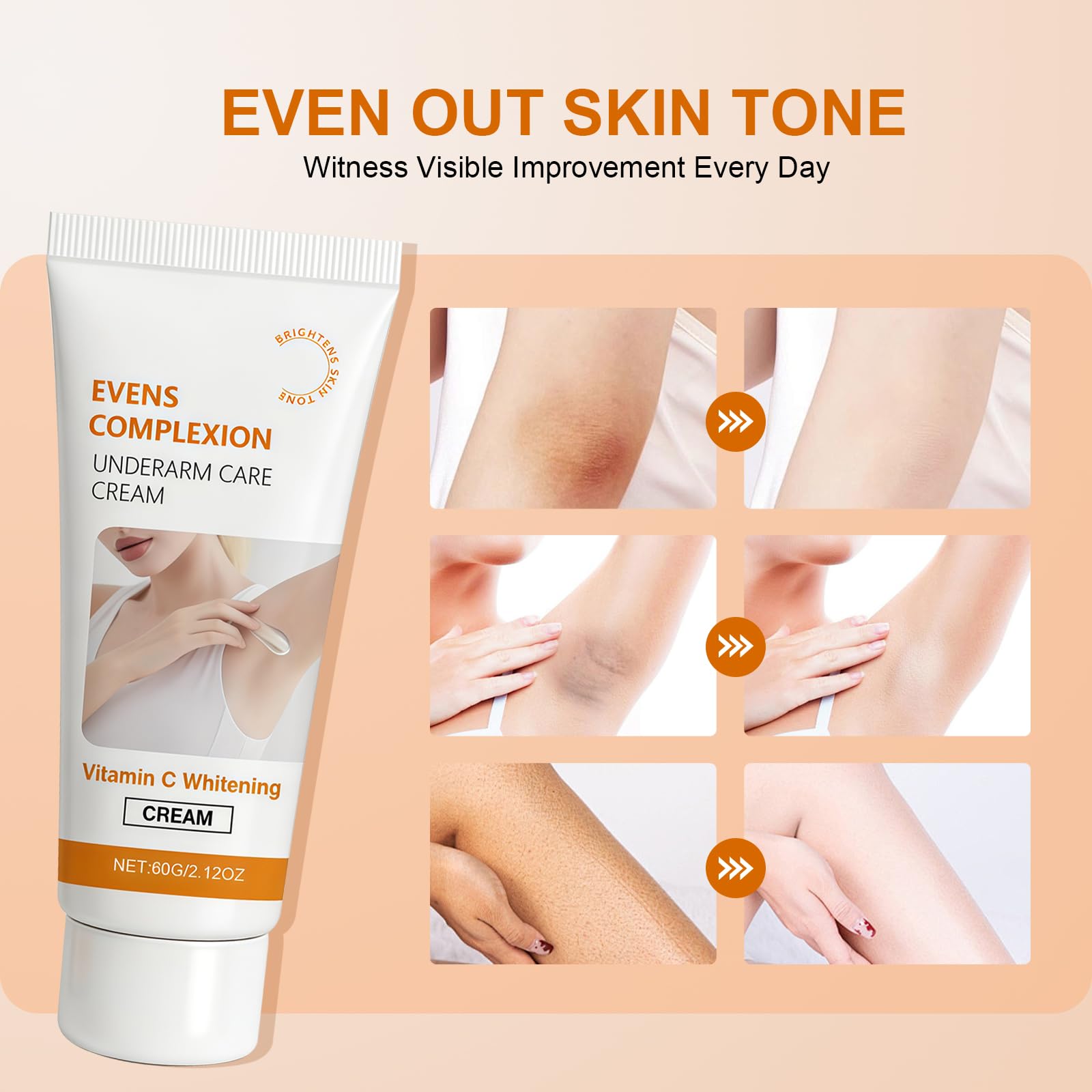 Crema Aclarante Corporal 120g,Tratamiento para Manchas Oscuras, Apto para Axilas,Rodillas y Zonas Íntimas,Hidratación Profunda para un Tono de Piel Más Uniforme y Suave — view 6